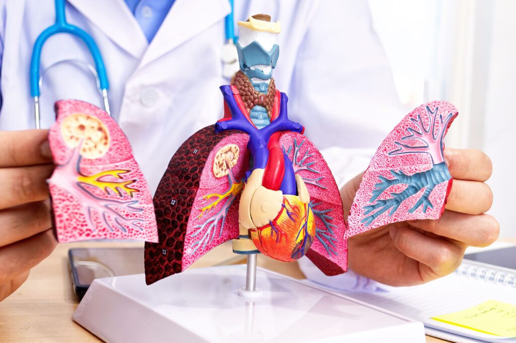 Doctor holding a Lung model