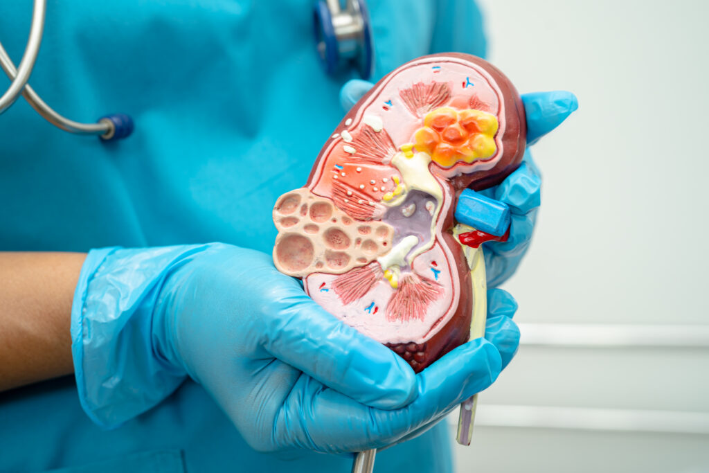 Doctor holding a kidney model