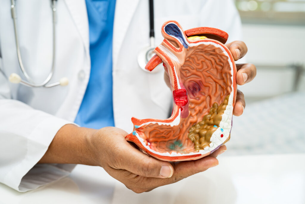 Doctor holding a stomach model